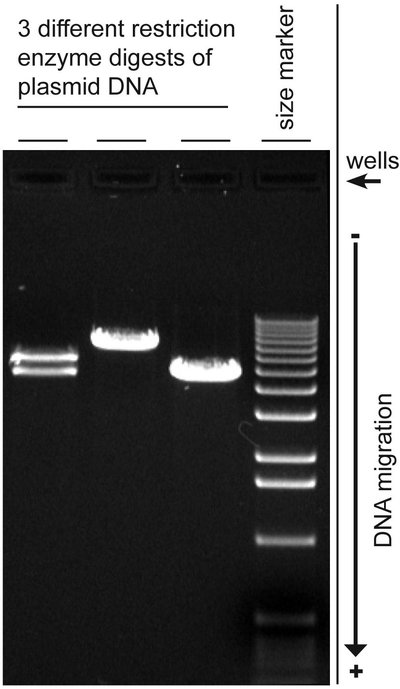 Agarose Gel Electrophoresis