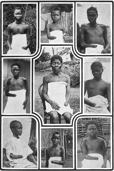 Atrocities in the Congo Free State