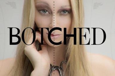 Botched (TV series)