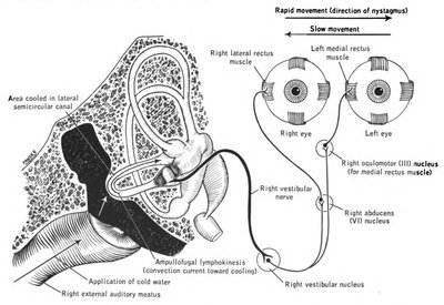 Caloric Reflex Test