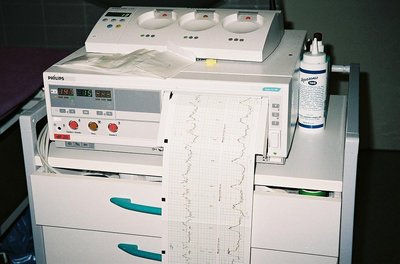 Cardiotocography
