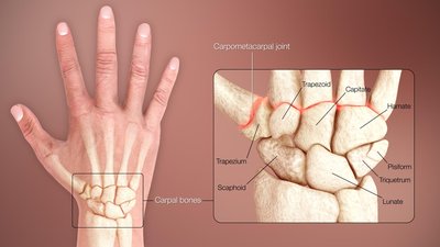 Carpal Bones