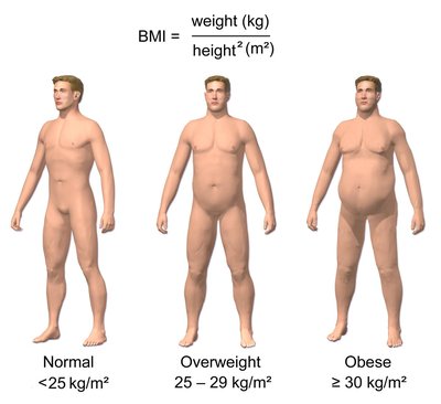 Classification of obesity