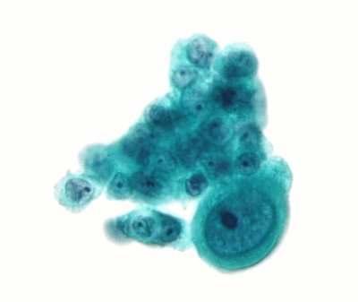 Cytopathology
