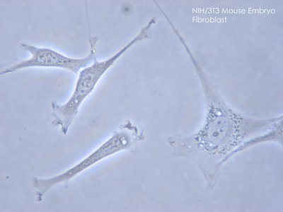 Fibroblast