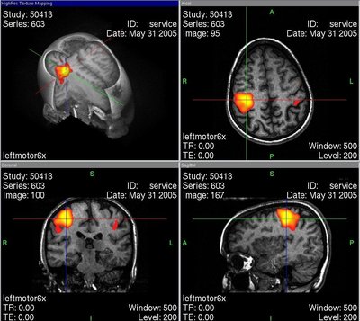 Functional Magnetic Resonance Imaging