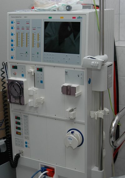Hemodialysis