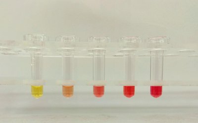 Hemolysis