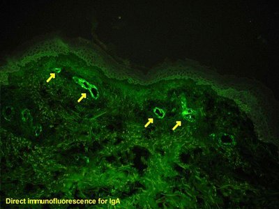 Immunofluorescence