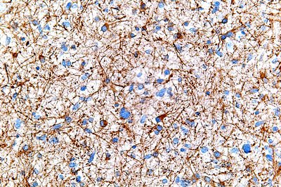 Immunostaining