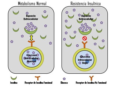 Insulin Resistance