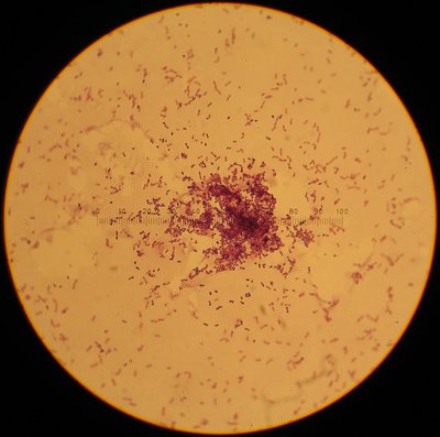 Lactococcus Lactis