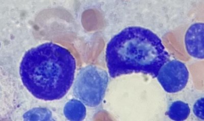 Mast Cell