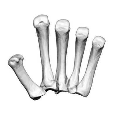 Metacarpal Bones