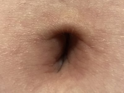Navel