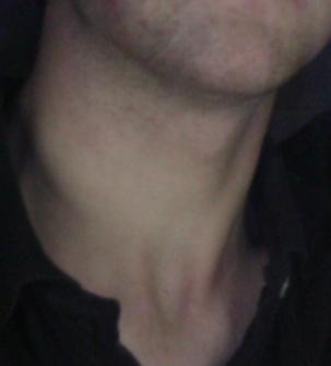 Neck