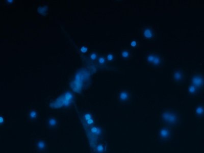 Neutrophil Extracellular Traps