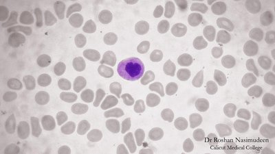 Neutrophil