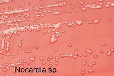 Nocardia