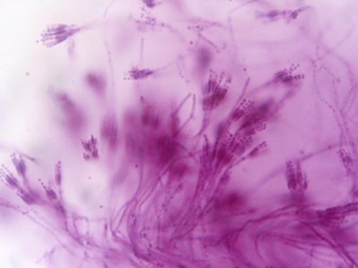 Penicillium