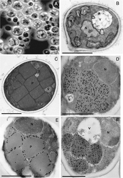 Peroxisome