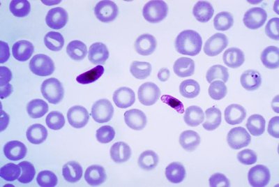 Plasmodium Falciparum