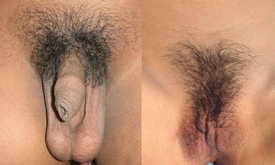Pubic Hair
