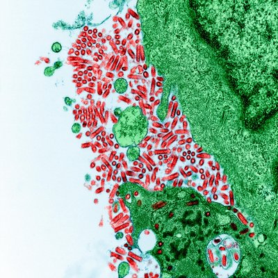 Rabies Virus