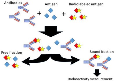 Radioimmunoassay