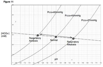 Respiratory Alkalosis