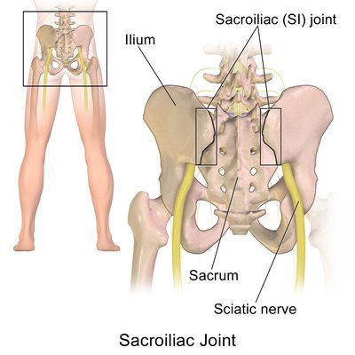 Sacroiliac Joint Dysfunction