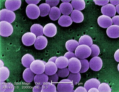 Staphylococcus Aureus