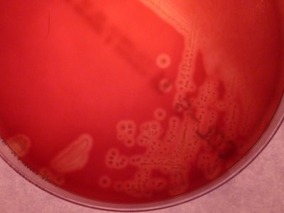 Streptococcus Agalactiae