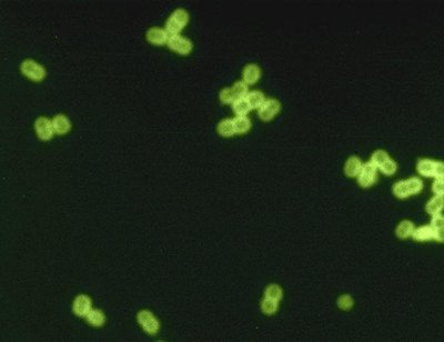 Streptococcus Pneumoniae