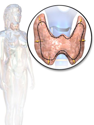 Thyroid Disease
