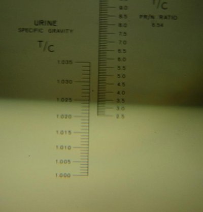 Urine Specific Gravity