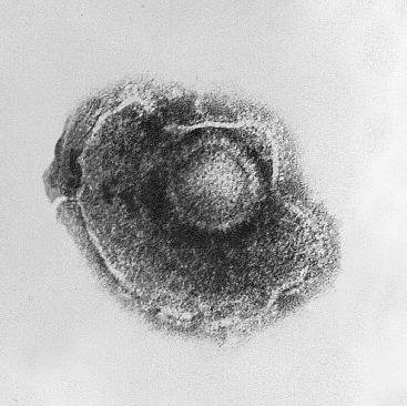 Varicella Zoster Virus