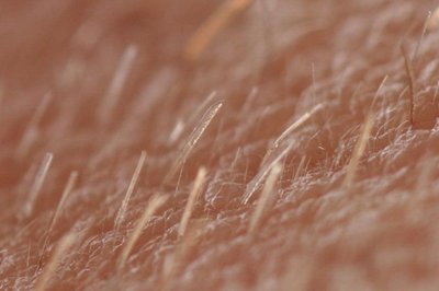 Vellus Hair