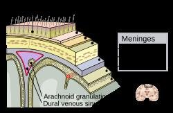 Viral Meningitis