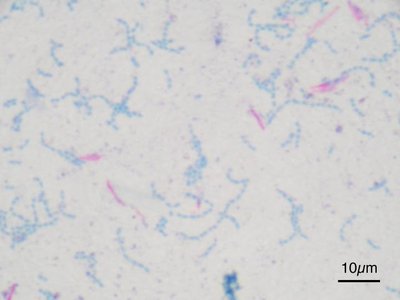 Ziehl–Neelsen Stain