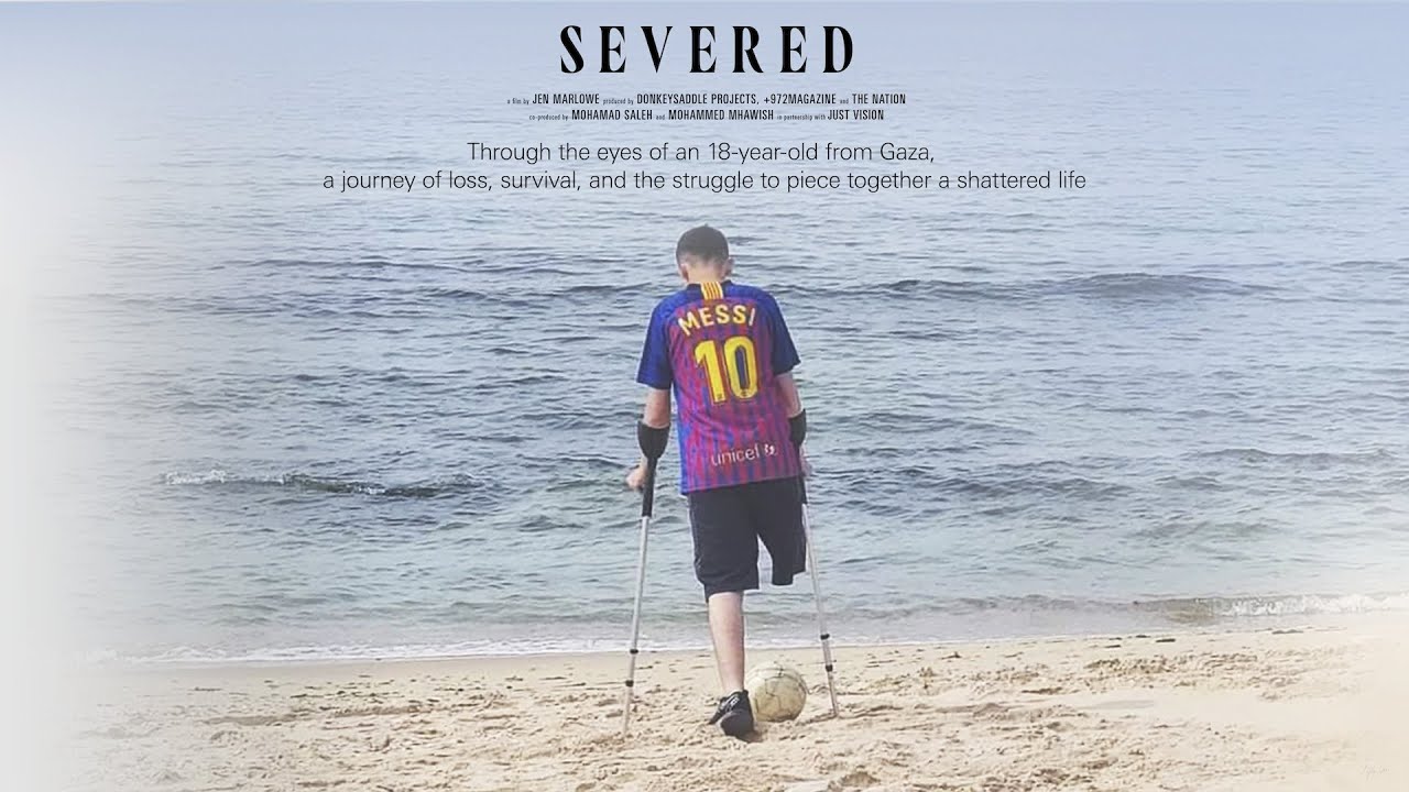 Severed: The Story of a Boy From Gaza